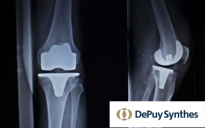 DePuy Touts Benefits of Attune Knee Despite High Failure Rates